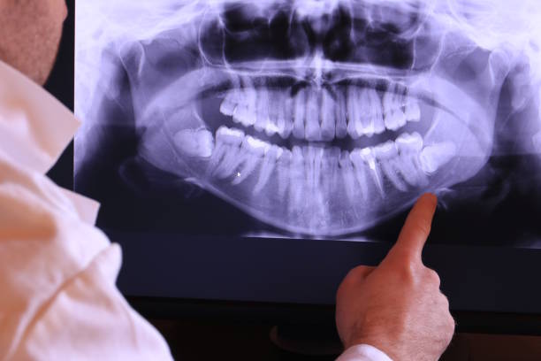 Best Broken or Cracked Tooth Emergency Dentist in Deltona, FL