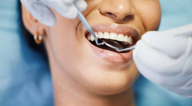 Best Emergency Dentist for Lost Fillings or Crowns in Deltona, FL